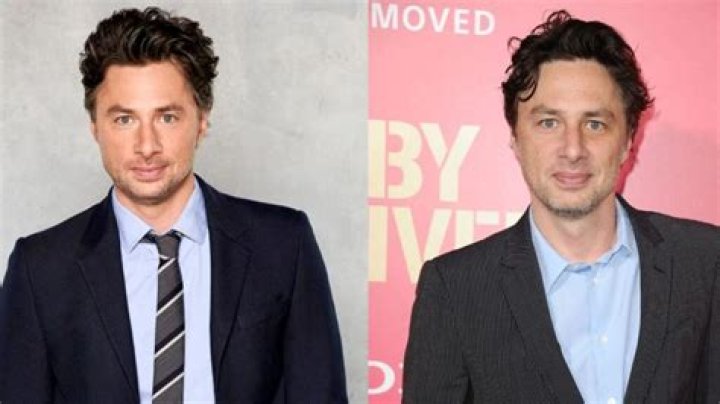 Does Zach Braff's Appearance Suggest Plastic Surgery?